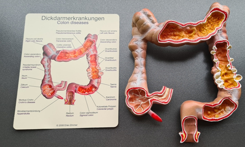 3D-Modell des Darms