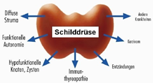 Von der Schilddrüse ausgehende Beschwerden