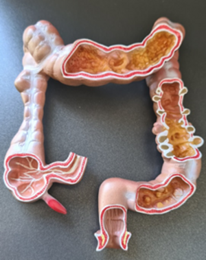 3D-Modell des Darms
