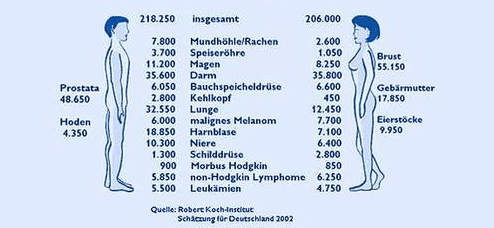 Darmkrebszentrum: Die häufigsten Krebsarten in Deutschland pro Jahr.