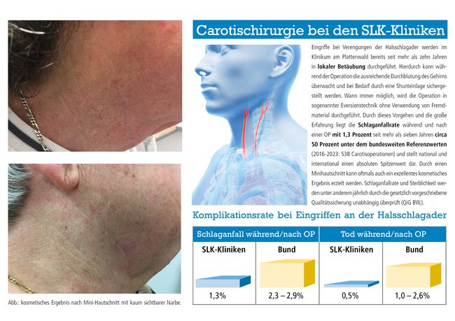 Infos zu einer Carotis-OP