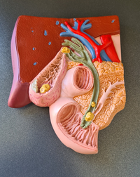 3D-Modell der Gallenblase (Gallenblasenoperation)