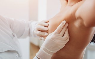 Abtastuntersuchung der weiblichen Brust