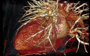 Radiologie: das Herz